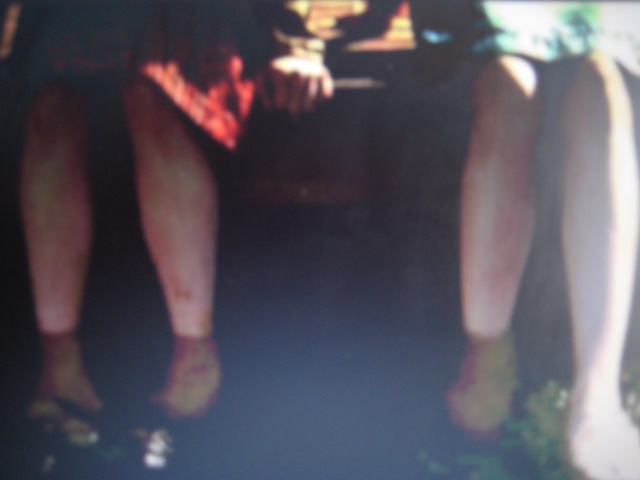 A Tale Of Two Legs Foto Fementido